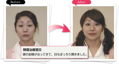 Before → After